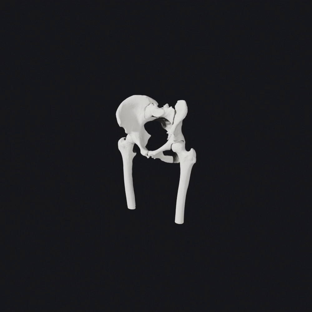 3D reconstruction of a hip joint generated from a CT scan